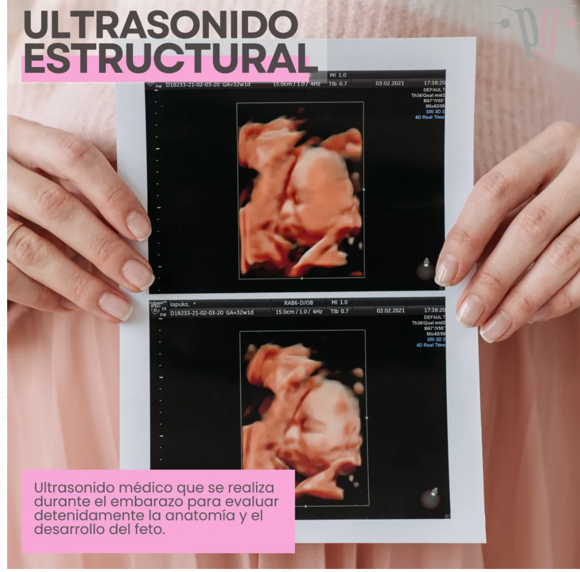 Foto 3 de Dr. Alfredo Ramírez Cárdenas.Materno-fetal., por Dr. Alfredo Ramírez Cárdenas.Materno-fetal.Ginecologo