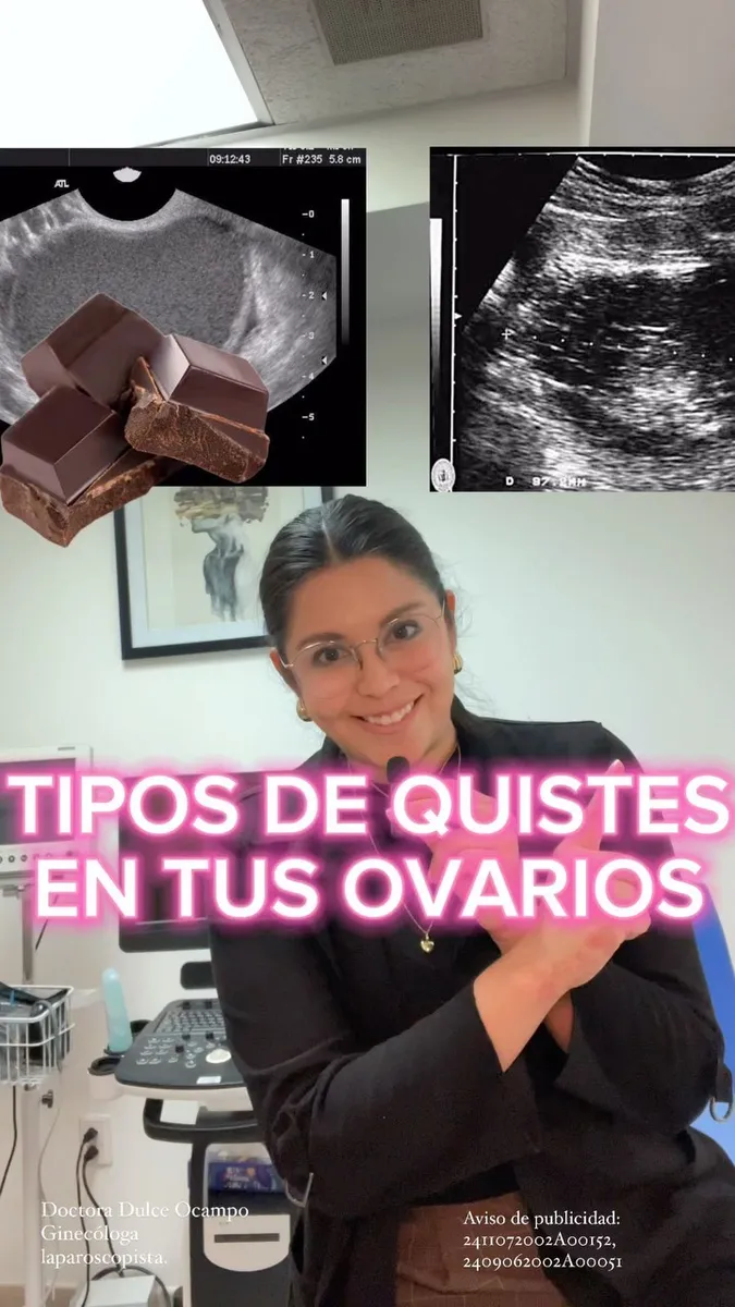 Foto 1 de Dra. Endorobotics Endometriosis y Cirugía de Mínima Invasión Dulce Ocampo, por ENDOLAP (ENDOMETRIOSIS Y LAPAROSCOPIA) DRA DULCE OCAMPO