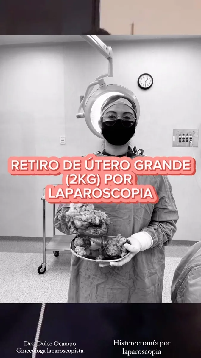 Foto 4 de Dra. Endorobotics Endometriosis y Cirugía de Mínima Invasión Dulce Ocampo, por ENDOLAP (ENDOMETRIOSIS Y LAPAROSCOPIA) DRA DULCE OCAMPO