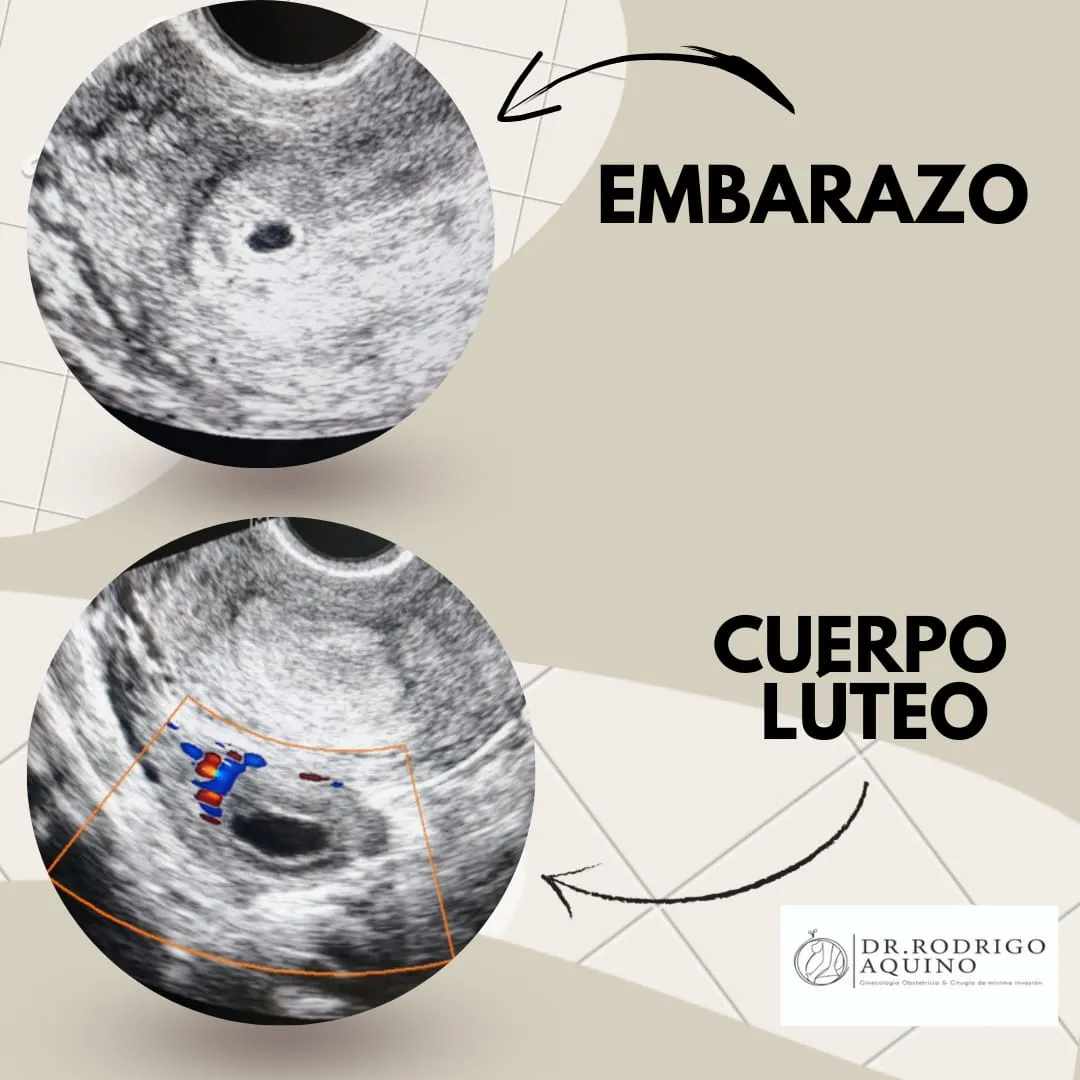 Foto 3 de Dr. Jose Rodrigo Aquino Vargas, por Dr. Jose Rodrigo Aquino Vargas, Ginecólogo Obstetra en Cdmx