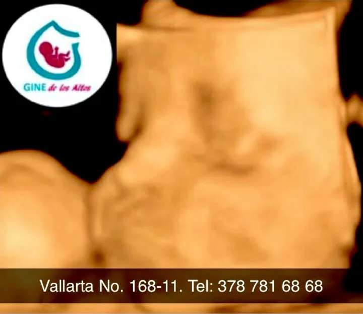 Foto 3 de Gine de Los Altos, por Gine de Los Altos
