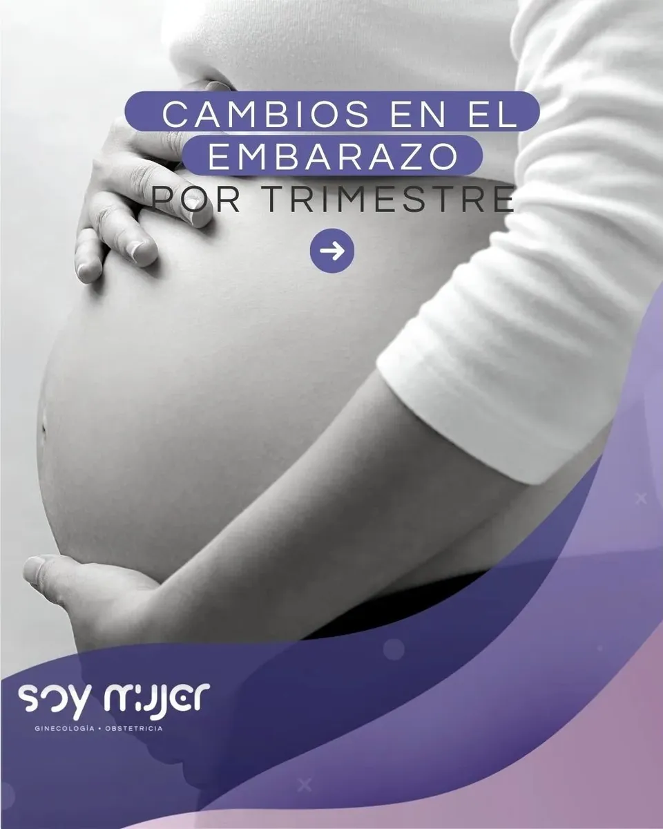 Foto 3 de Soy Mujer, por Soy Mujer