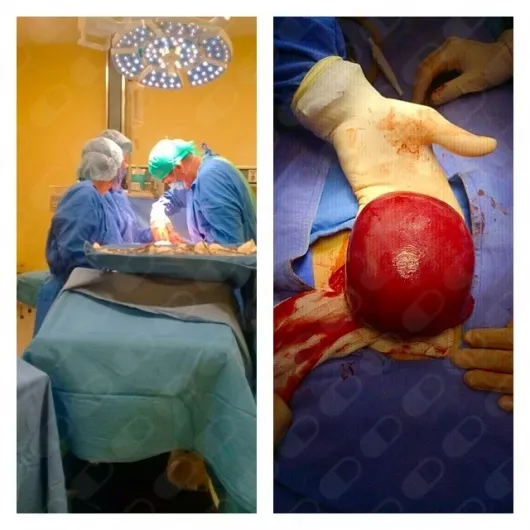 Foto 4 de Dr. Arturo Simont Zeron, por Dr. Arturo Simont Zeron, Ginecólogo