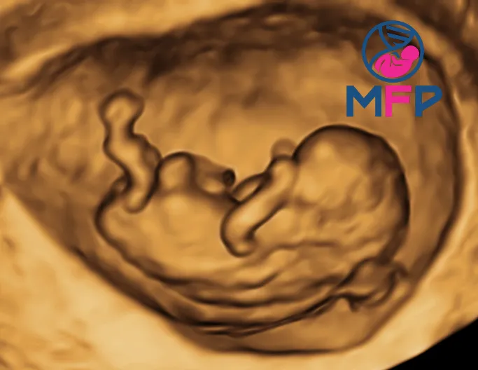Foto 1 de PreMommy, por PreMommy - Medicina Materno Fetal - Medicina y Cirugía Fetal Puebla