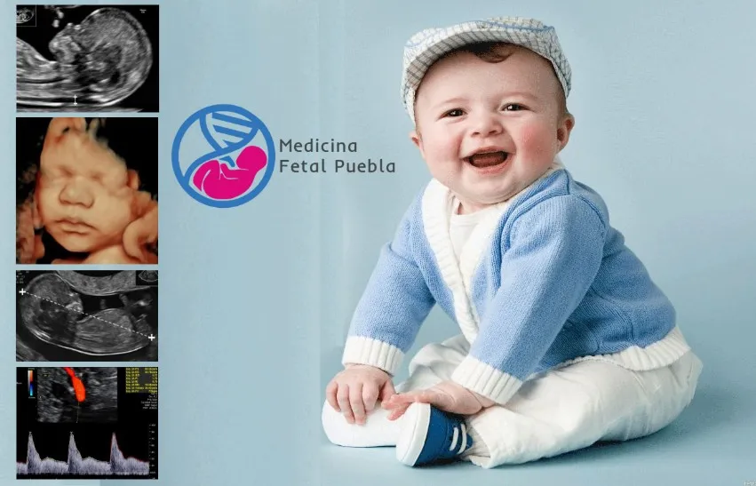 Foto 2 de PreMommy, por PreMommy - Medicina Materno Fetal - Medicina y Cirugía Fetal Puebla