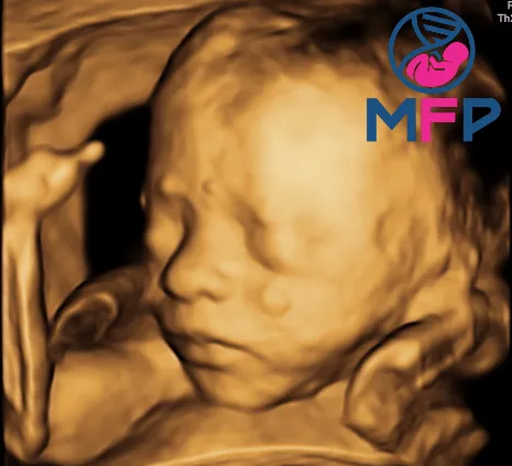 Foto 4 de PreMommy, por PreMommy - Medicina Materno Fetal - Medicina y Cirugía Fetal Puebla