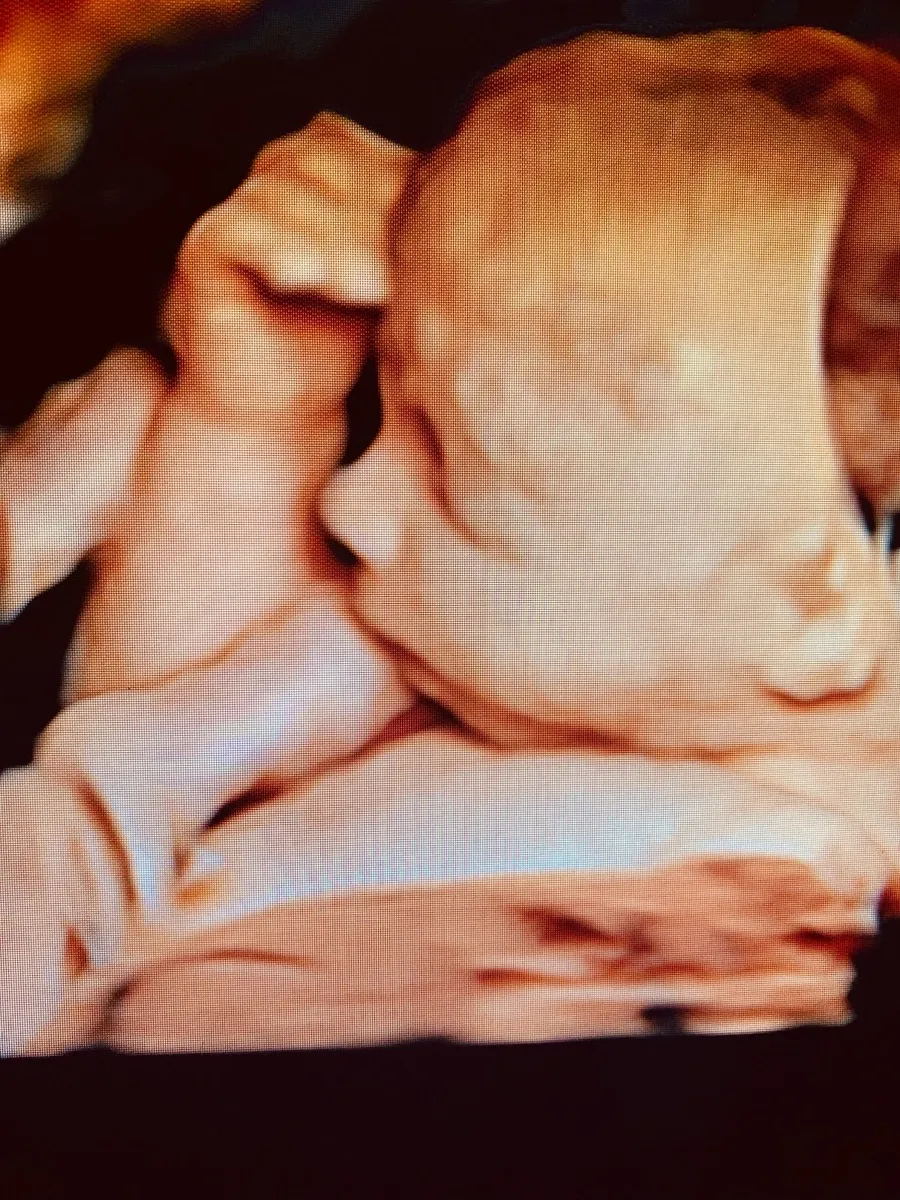 Foto 4 de GyneCare del Pedregal, por GyneCare del Pedregal
