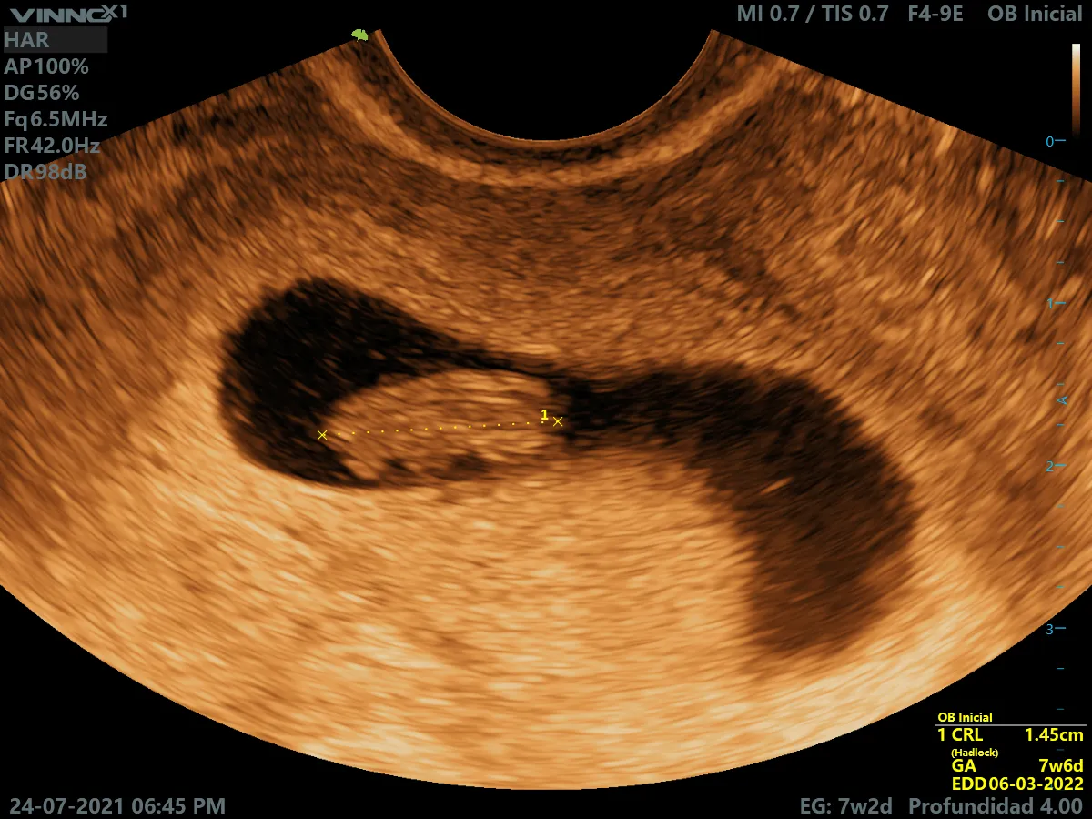 Foto 2 de Dr. Marcos Acosta Martínez, por Dr. Marcos Acosta Martínez Ginecólogo Obstetra