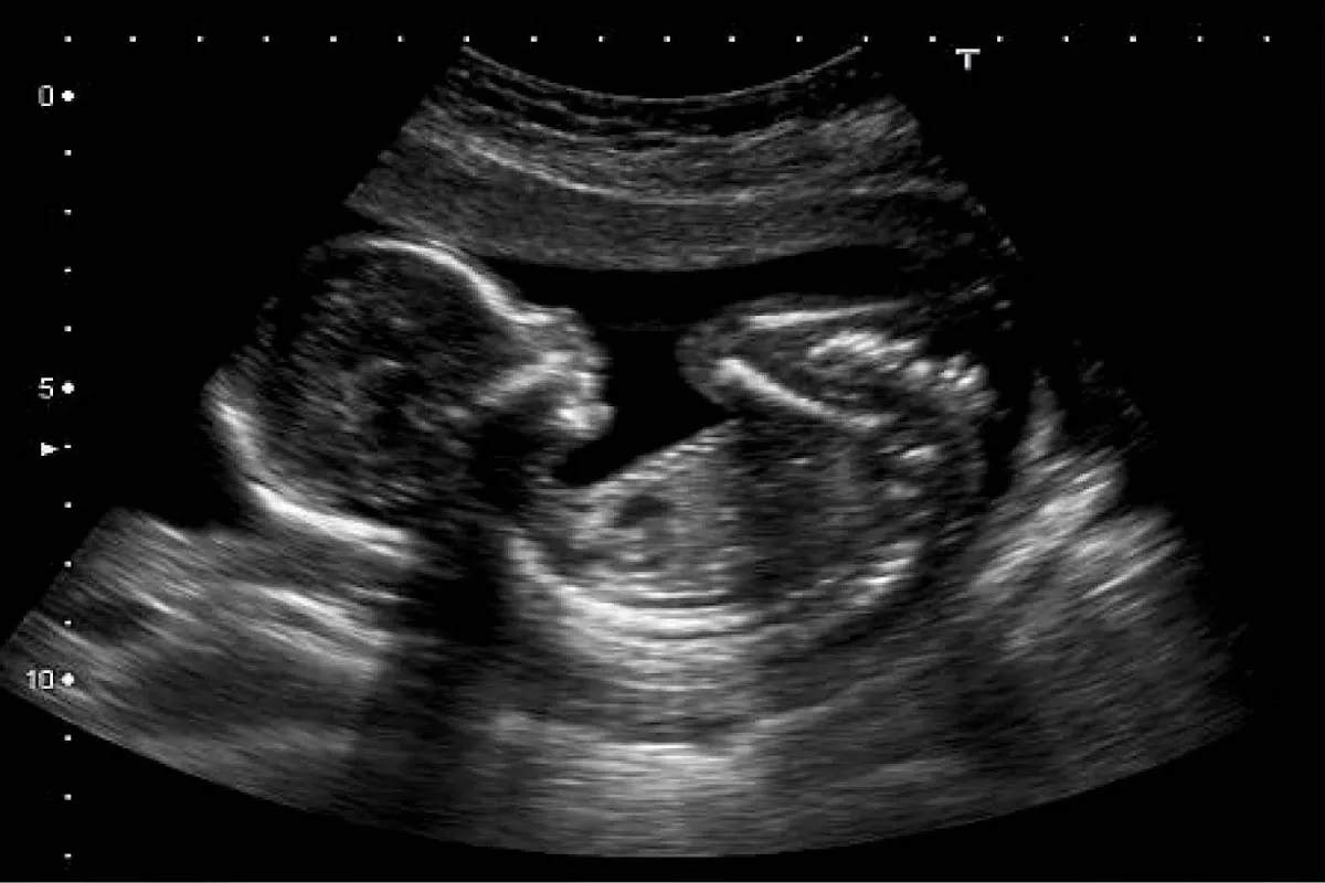 Foto 4 de Dr. Sergio Alfredo Ramos Pérez, por Dr. Sergio Alfredo Ramos Pérez, Ginecología y Obstetricia