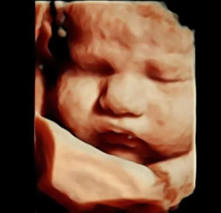 Foto 1 de Dra. Odette Noyola Landázuri, por Dra Odette Noyola Landázuri - Materno Fetal | Ginecología y Obstetricia