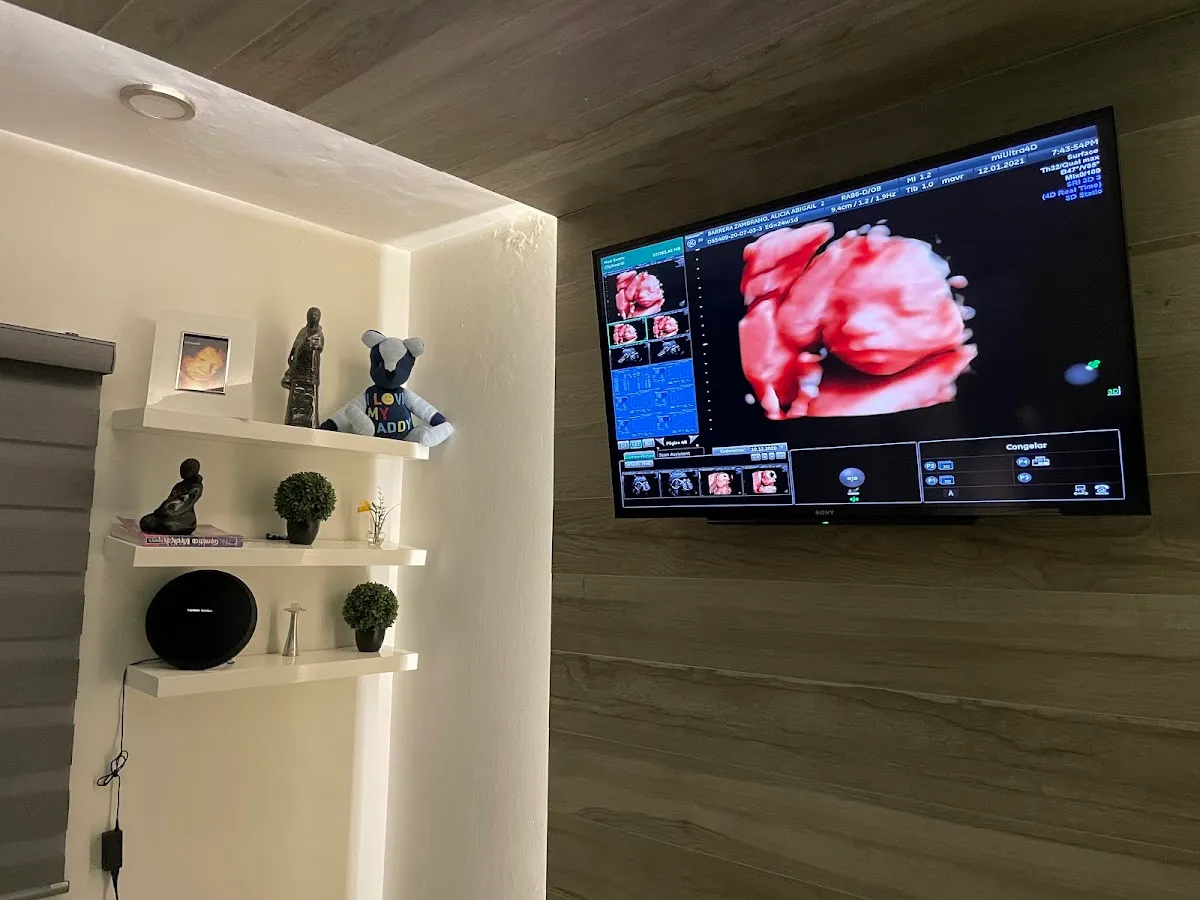 Foto 2 de 4D/5D miUltra4D, por GINECOLOGO & ULTRASONIDO 4D/5D (miUltra4D)