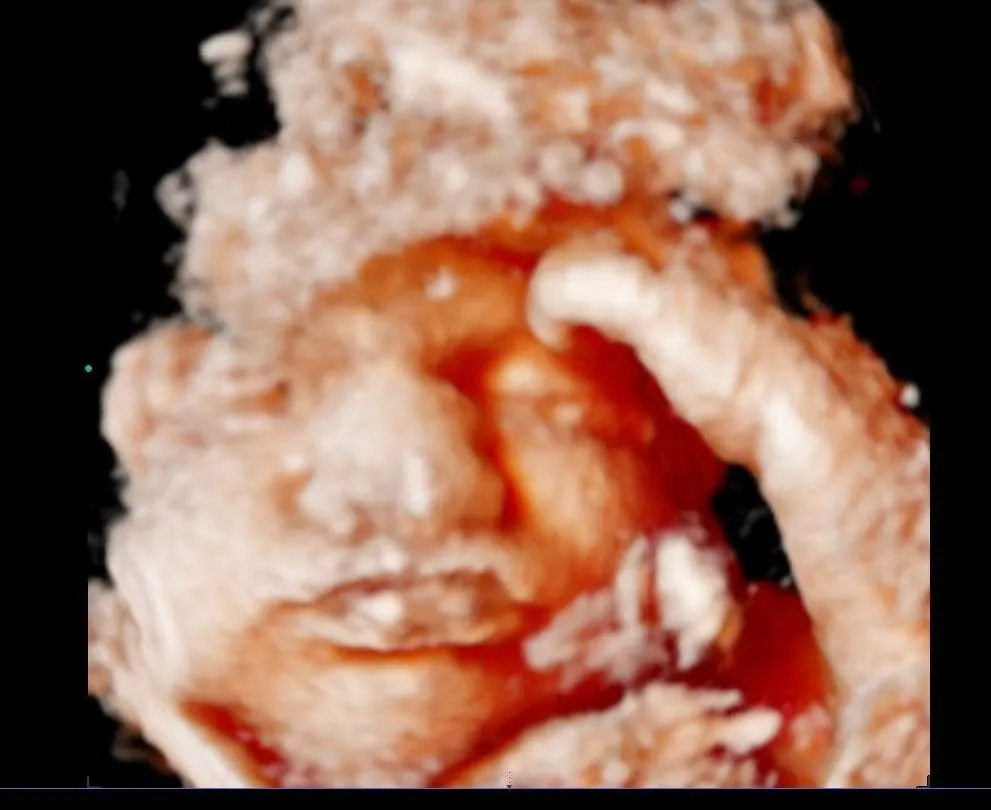 Foto 4 de Dra. Dulce Maria Lopez Peregrino, por DRA DULCE MARIA LOPEZ PEREGRINO GINECOLOGIA, OBSTETRICIA Y COLPOSCOPIA
