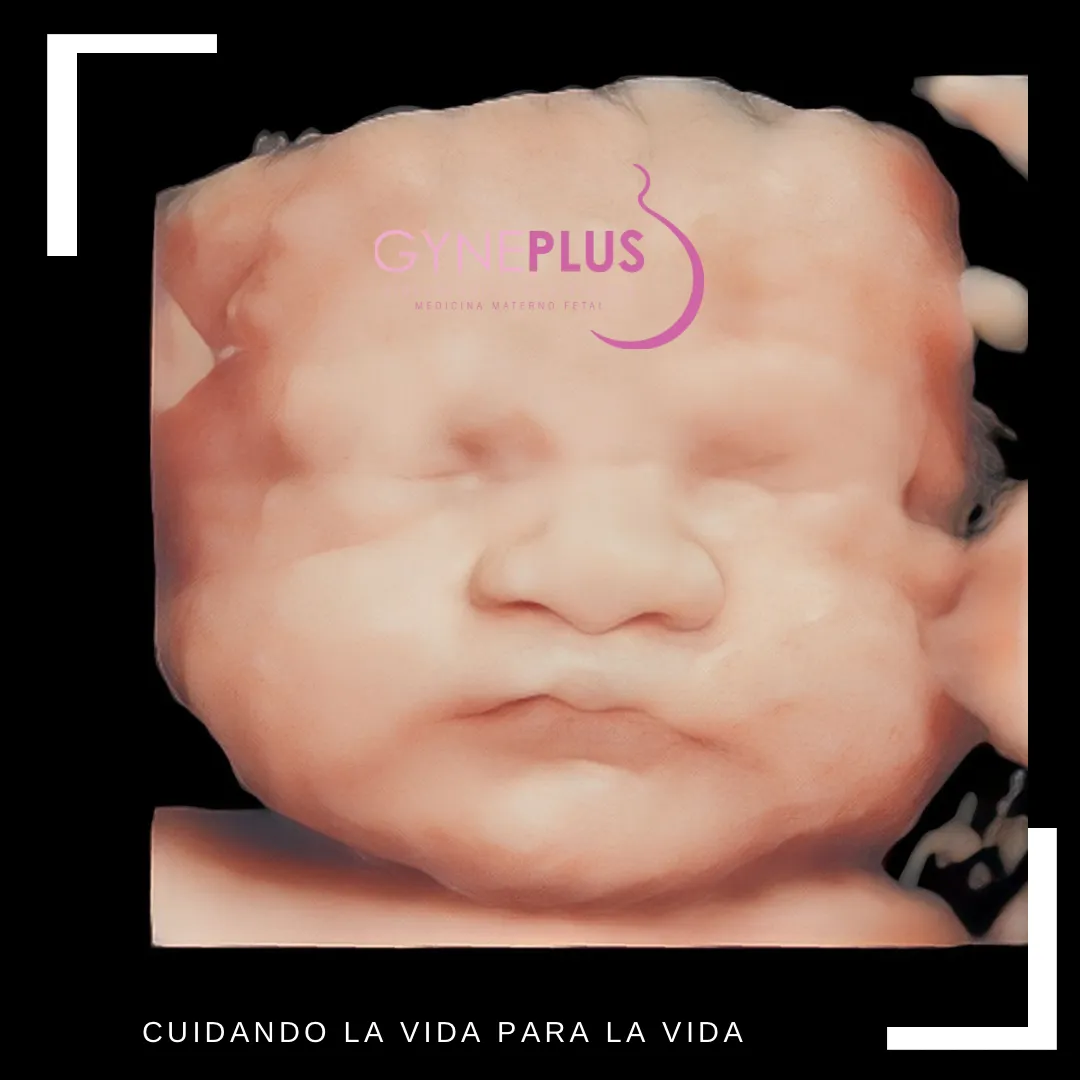 Foto 1 de Dra. Laura C Aragón Viloria, por Gyneplus - Dra Laura C Aragón Viloria / Medicina Materno Fetal - Ginecología y Obstetricia
