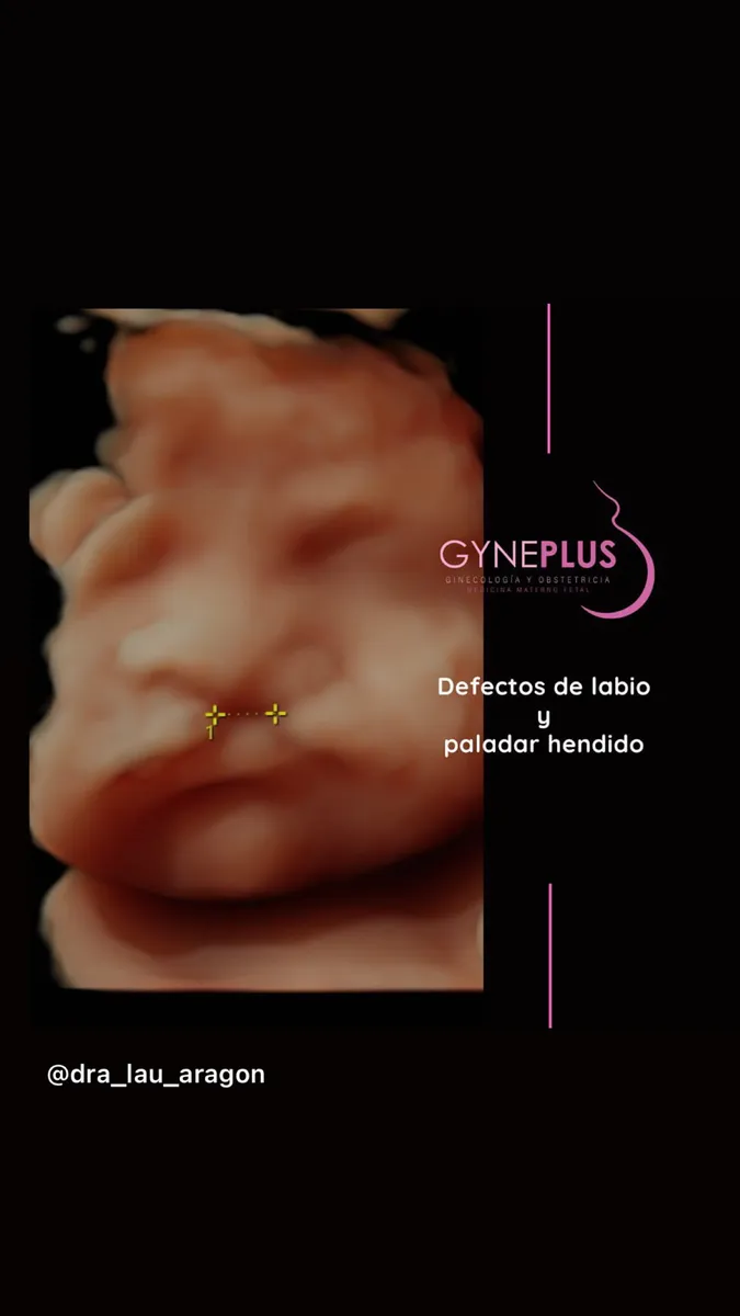 Foto 2 de Dra. Laura C Aragón Viloria, por Gyneplus - Dra Laura C Aragón Viloria / Medicina Materno Fetal - Ginecología y Obstetricia