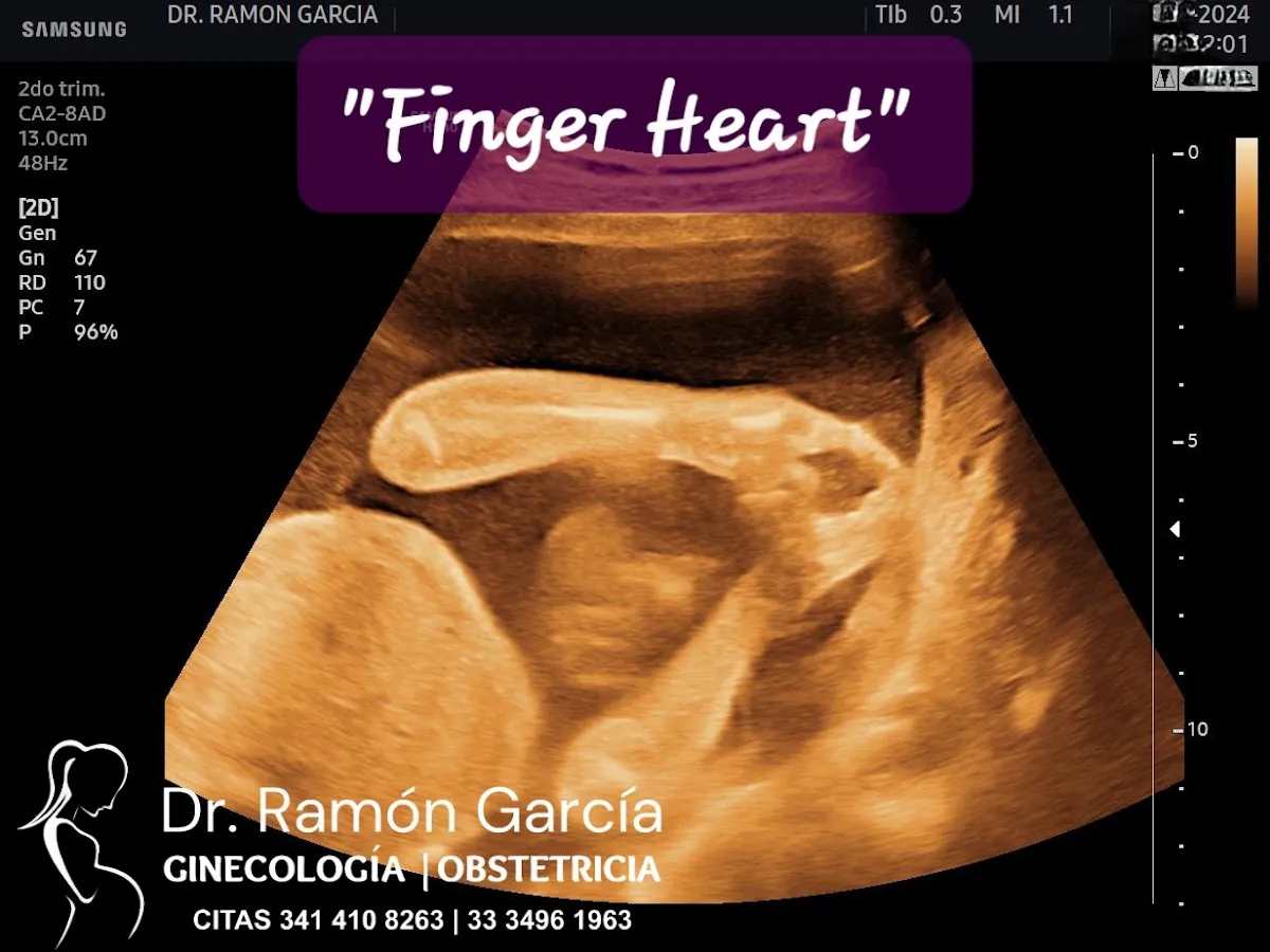 Foto 4 de Dr. Ramón García Flores; Ciudad Guzmán, por Dr. Ramón García Flores; Ginecólogo Ciudad Guzmán