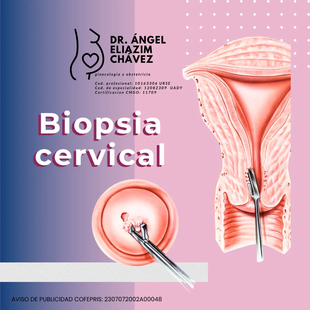 Foto 4 de Dr. Ángel Eliazim Chávez, por Dr. Ángel Eliazim Chávez Ginecología y Obstetricia
