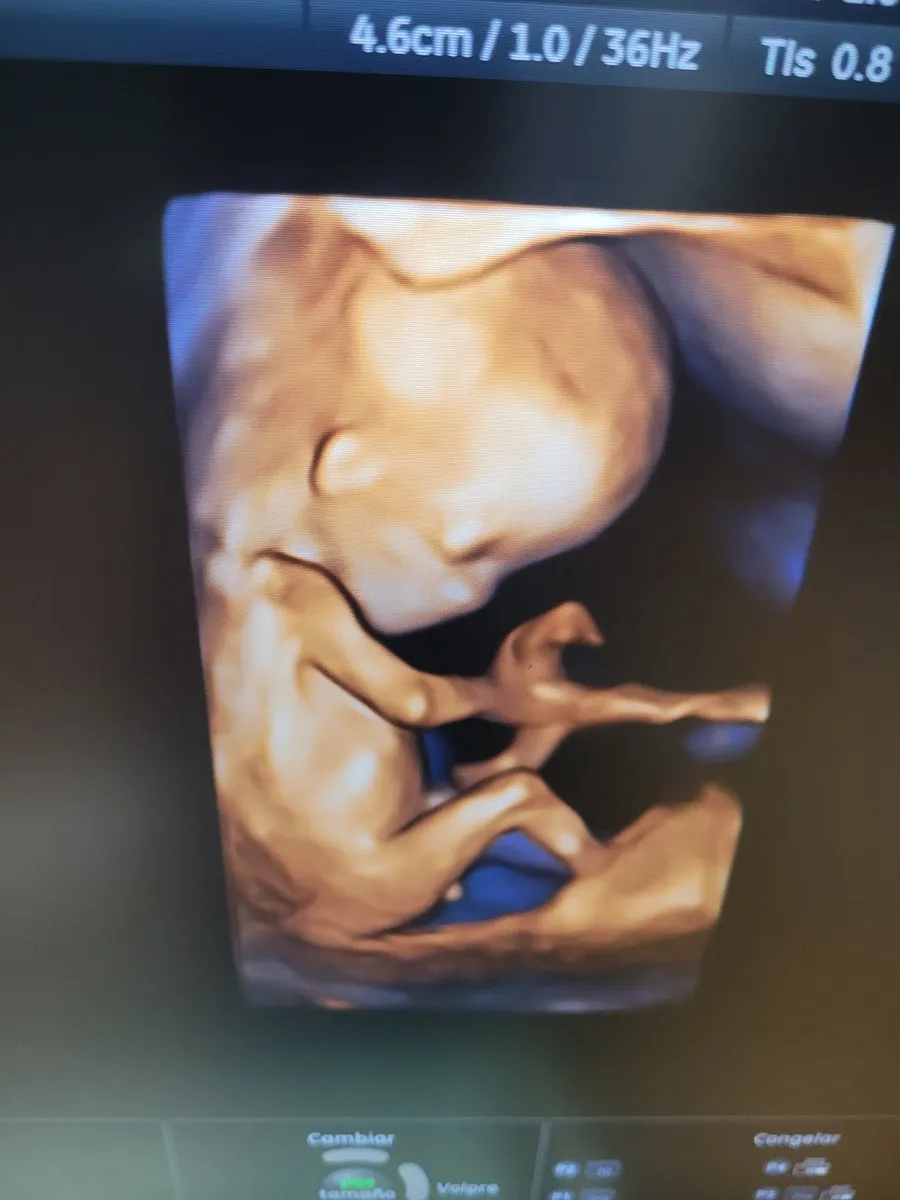 Foto 2 de Dr. Victor Eduardo Hernandez del Villar., por Dr Victor Eduardo Hernandez del Villar. Ginecologia y obstetricia