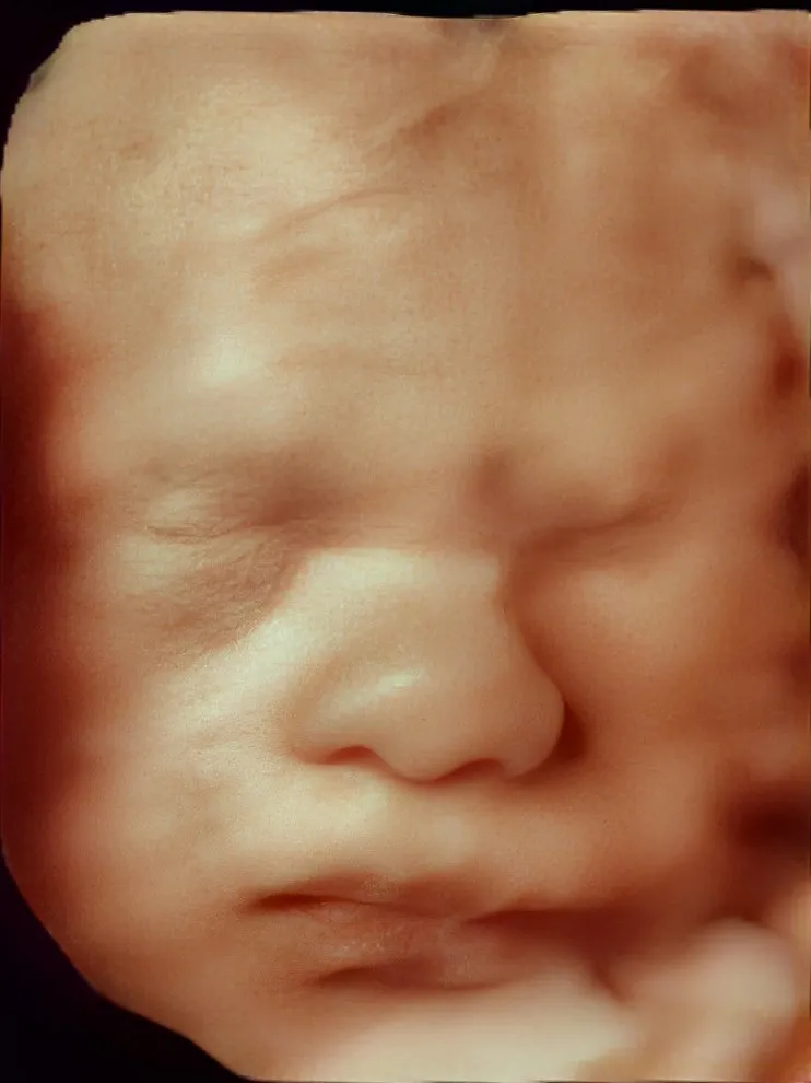 Foto 4 de Dr. Alan Gurrola Medicina, por Dr. Alan Gurrola Medicina Materno Fetal