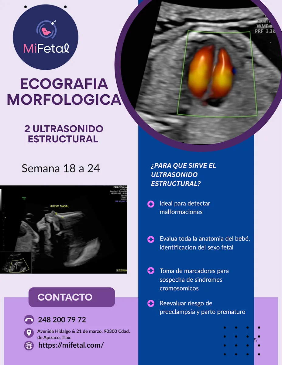 Foto 3 de MiFetal, por MiFetal