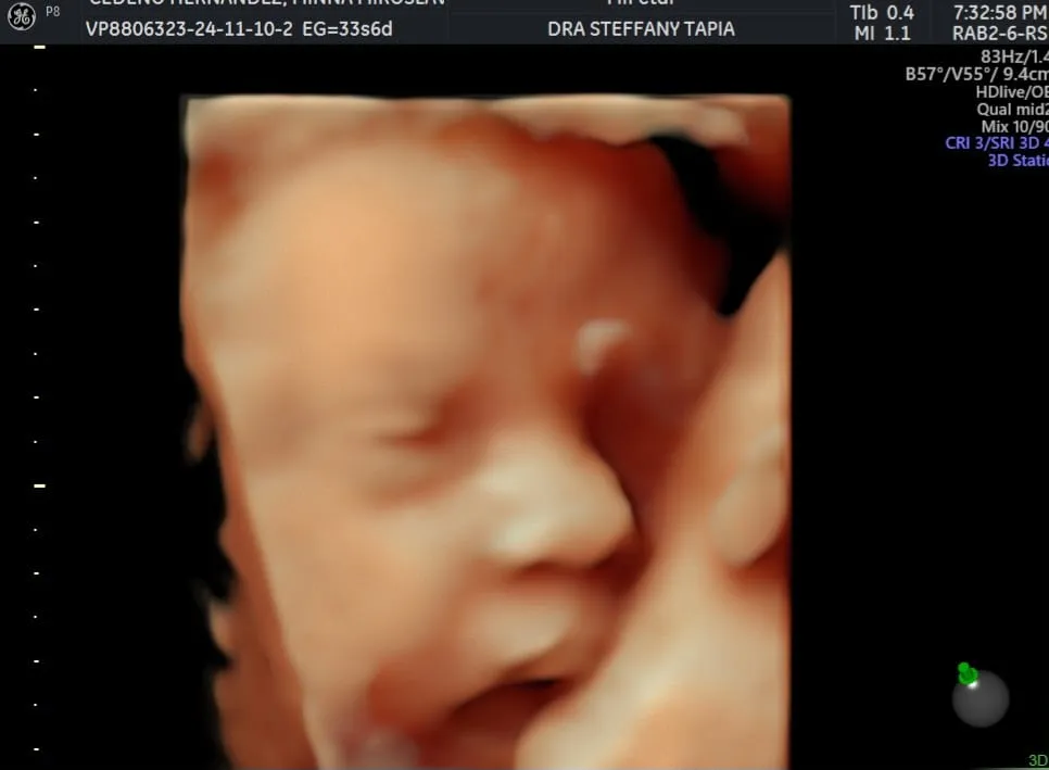 Foto 4 de MiFetal, por MiFetal