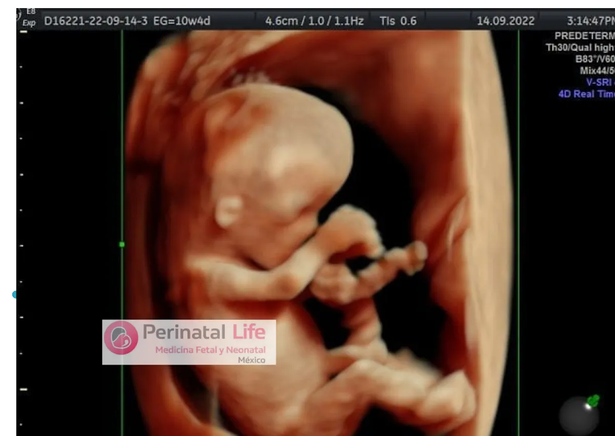 Foto 4 de Ginecóloga/Medico Materno Fetal/Flor Casillas/Control de Embarazo/Ultrasonido Estructural/Parto y Cesárea Humanizada, por Ginecóloga/Medico Materno Fetal/Flor Casillas/Control de Embarazo/Ultrasonido Estructural/Parto y Cesárea Humanizada