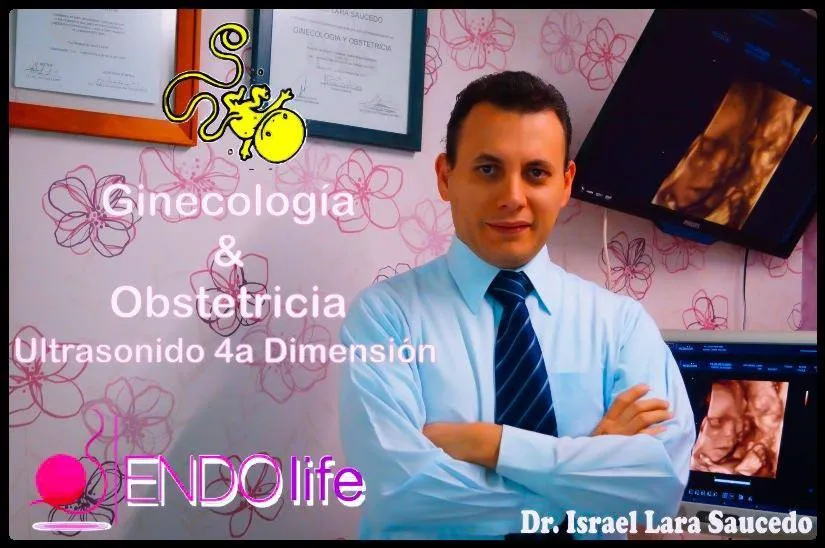 Foto 4 de Dr. Israel Lara Saucedo, por Dr Israel Lara Saucedo