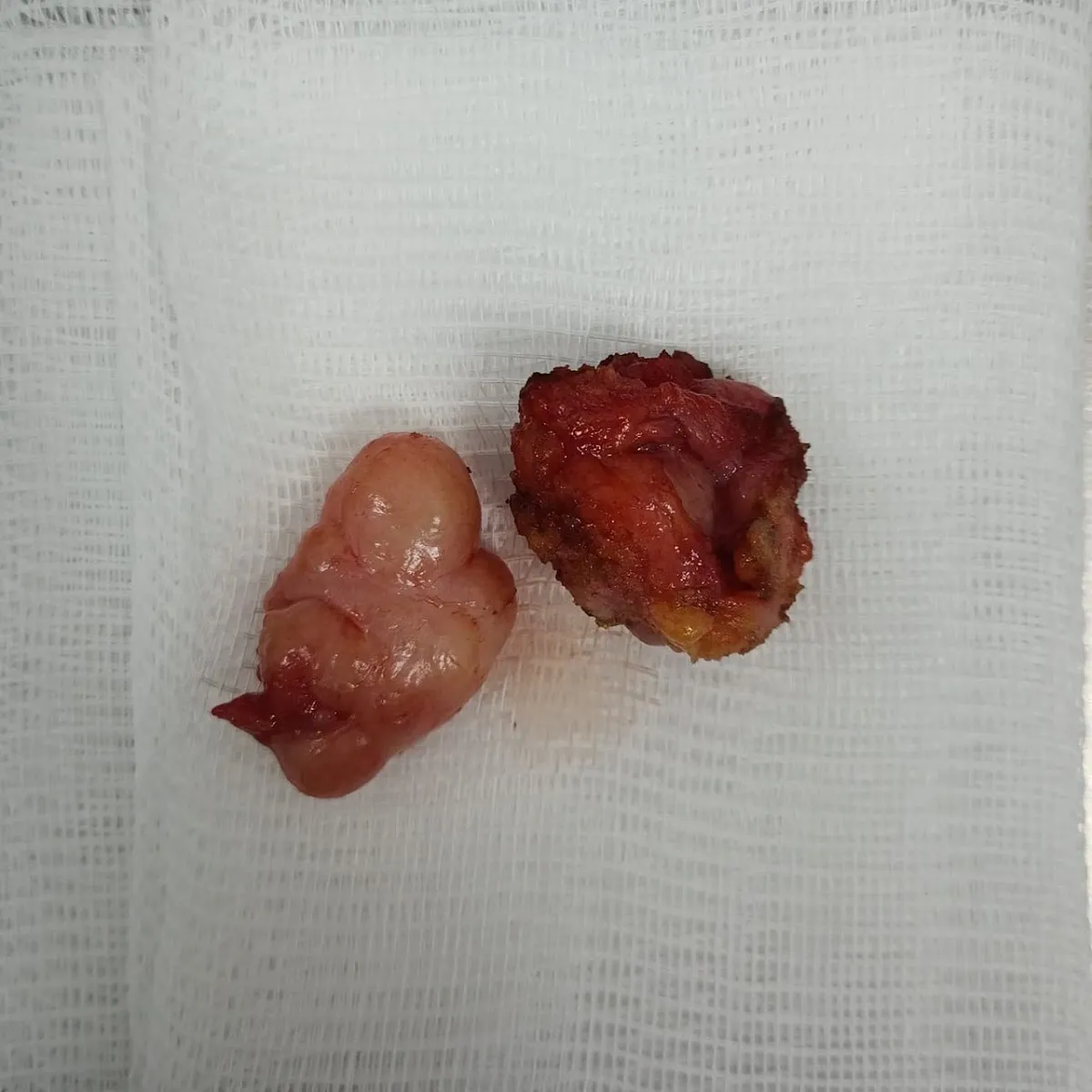 Foto 4 de Dr. Edgar Flores Saucedo, por Dr. Edgar Flores Saucedo, Ginecólogo Obstetra Subespecilidad Ginecologia Oncologica