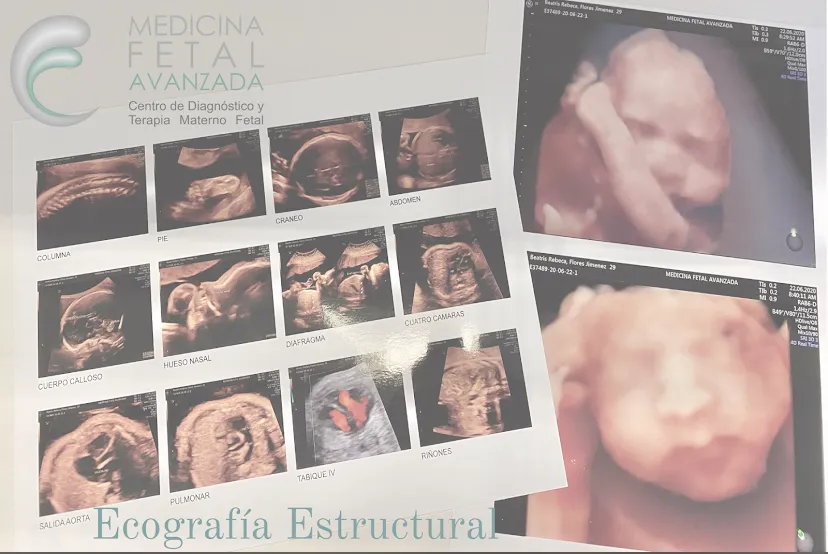 Foto 1 de Medicina Fetal Avanzada CDMX, por Medicina Fetal Avanzada CDMX