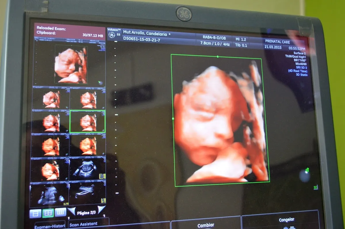 Foto 3 de Prenatal, por Packo Knt