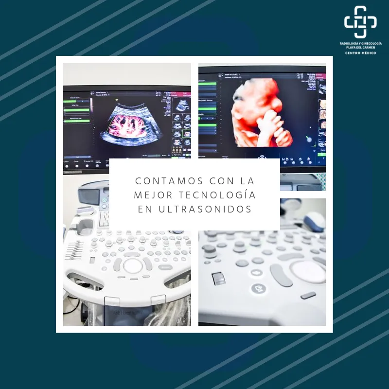 Foto 3 de Dra. Imagyn Radiología y 3d 4d Olan y Dr Navarrete, por Imagyn Ginecologia Radiología y Ultrasonido 3d 4d Dra. Olan y Dr Navarrete