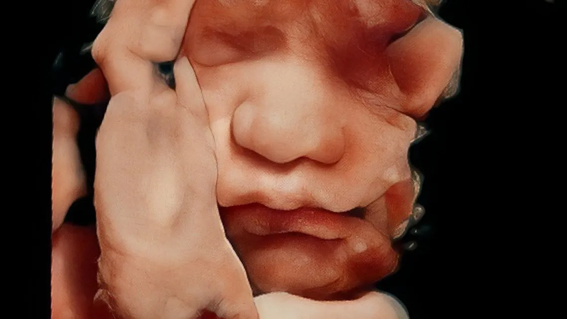 Foto 1 de Medicina Fetal Tesistan, por Ginecología & Medicina Fetal Tesistan
