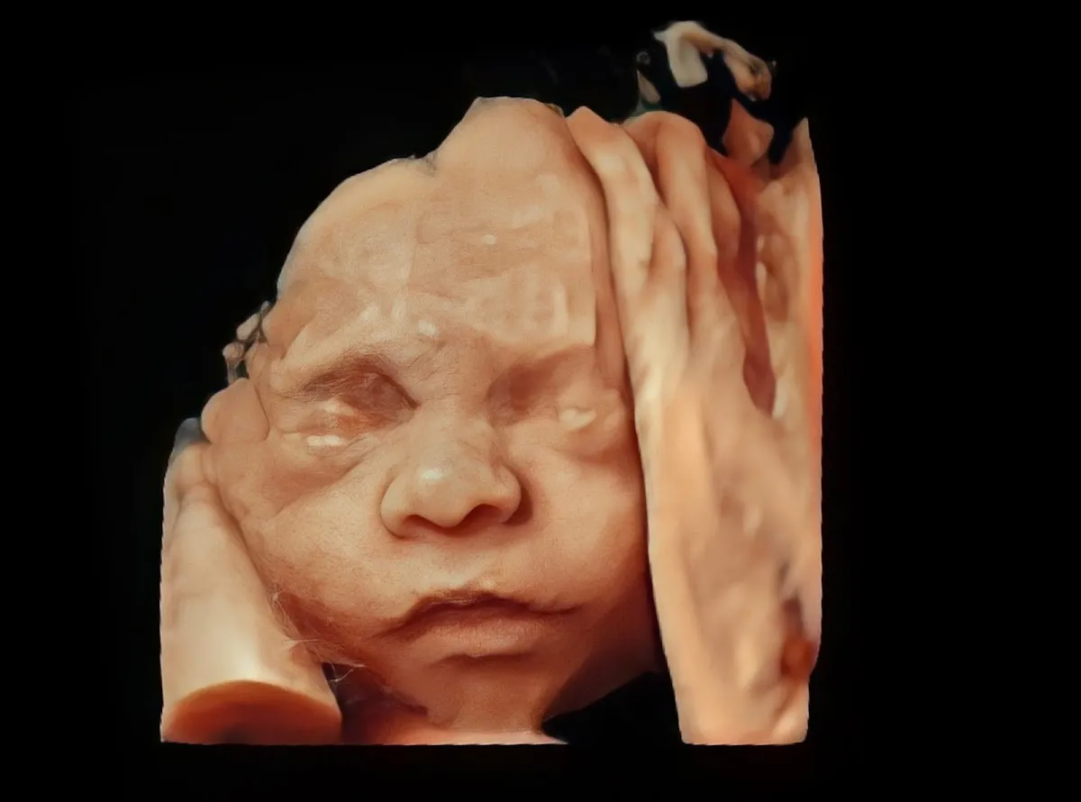 Foto 4 de Medicina Fetal Tesistan, por Ginecología & Medicina Fetal Tesistan