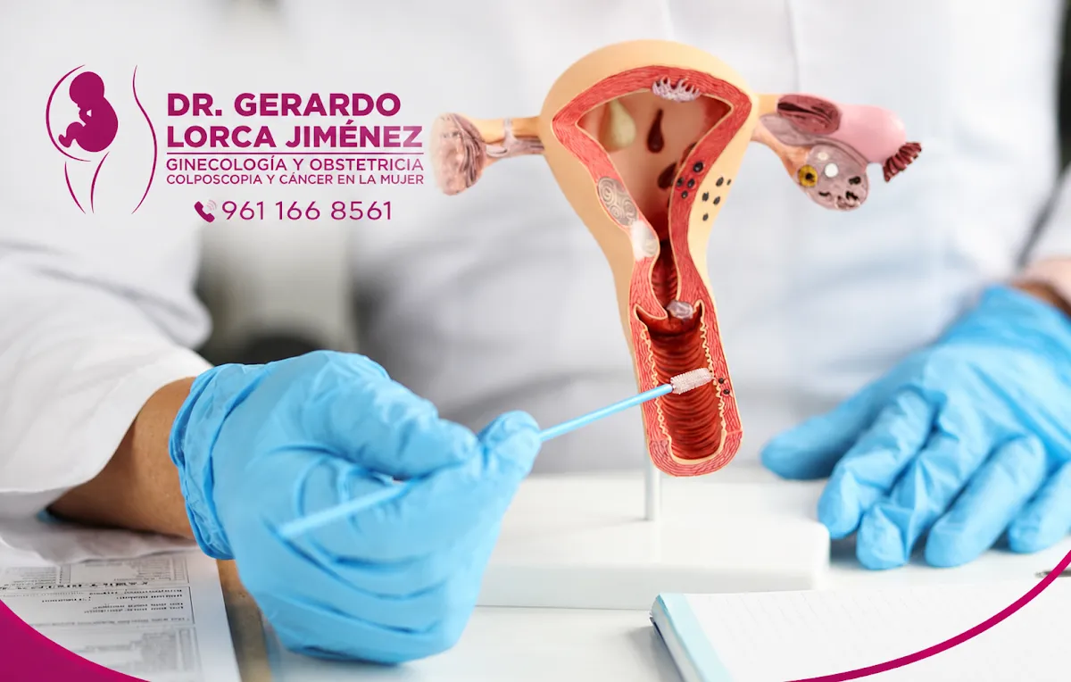 Foto 2 de Ginecólogo en Puebla Dr. Gerardo Lorca Jiménez, por Ginecólogo en Puebla Dr. Gerardo Lorca Jiménez