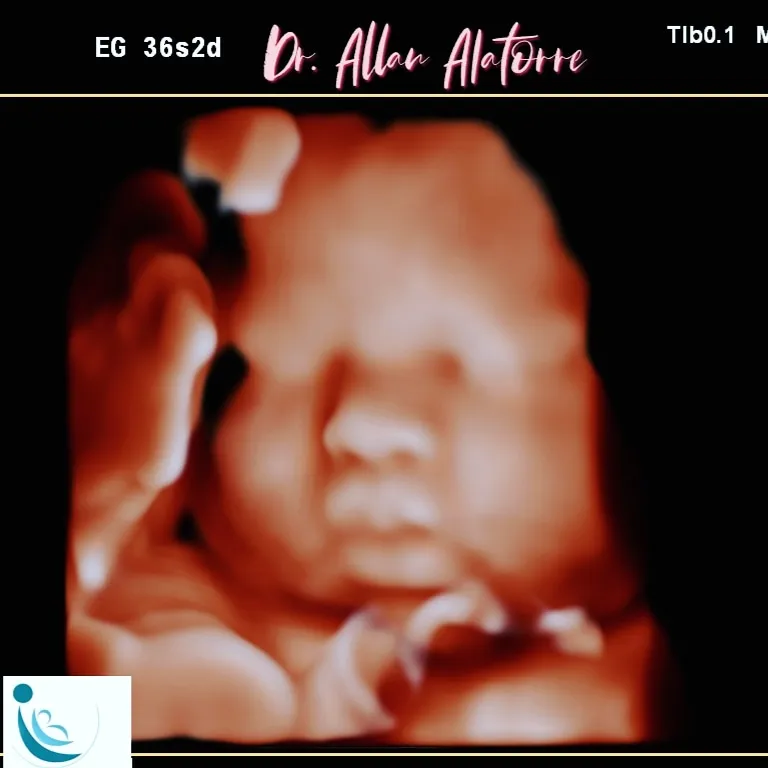 Foto 4 de Dr. Saltillo Allan Alatorre, por Ginecología y Obstetricia Saltillo Dr. Allan Alatorre