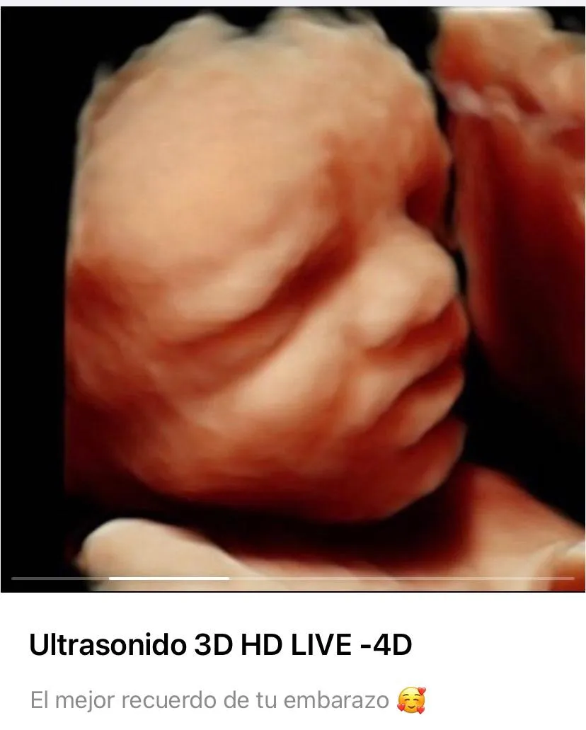 Foto 2 de Dra. Cristina Sánchez y medicina fetal, por Dra Cristina Sánchez ginecologia y medicina fetal