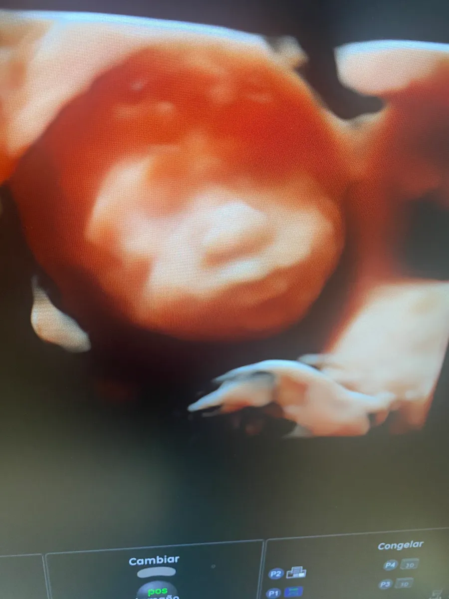 Foto 3 de Dra. Cristina Sánchez y medicina fetal, por Dra Cristina Sánchez ginecologia y medicina fetal