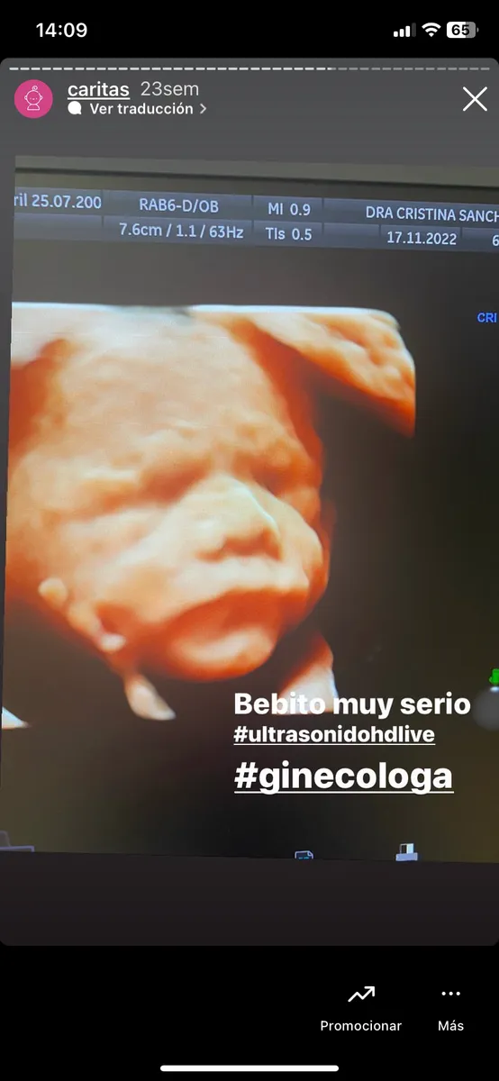 Foto 4 de Dra. Cristina Sánchez y medicina fetal, por Dra Cristina Sánchez ginecologia y medicina fetal