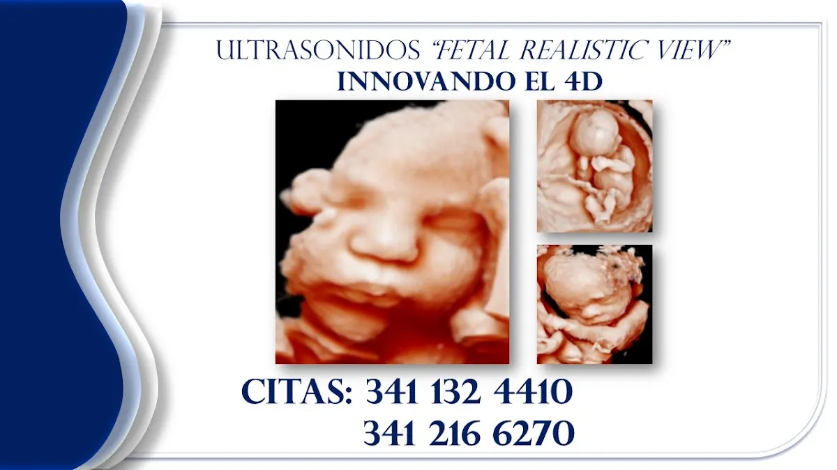 Foto 4 de Dr. Omar Alejandro Perez Perez, por DR. OMAR ALEJANDRO PEREZ PEREZ, GINECOLOGÍA Y OBSTETRICIA