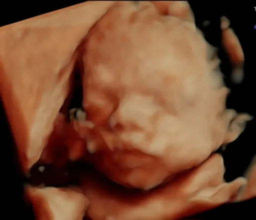 Foto 4 de Cuidar:, por CUIDAR: Ginecología y Obstetricia
