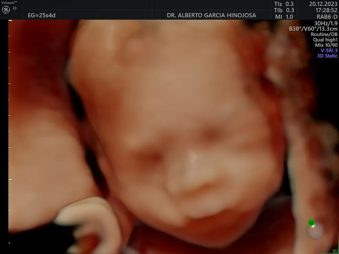 Foto 4 de Dr. Alberto Garcia Hinojosa, por Dr. Alberto Garcia Hinojosa, Ginecología y Obstetricia.