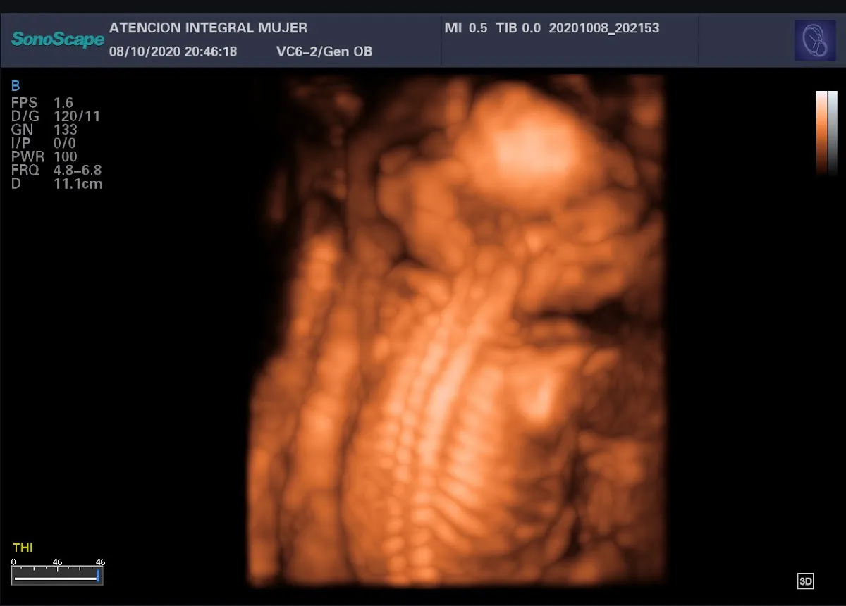 Foto 4 de Zelomi, por ZELOMI, GINECOLOGIA Y OBSTETRICIA