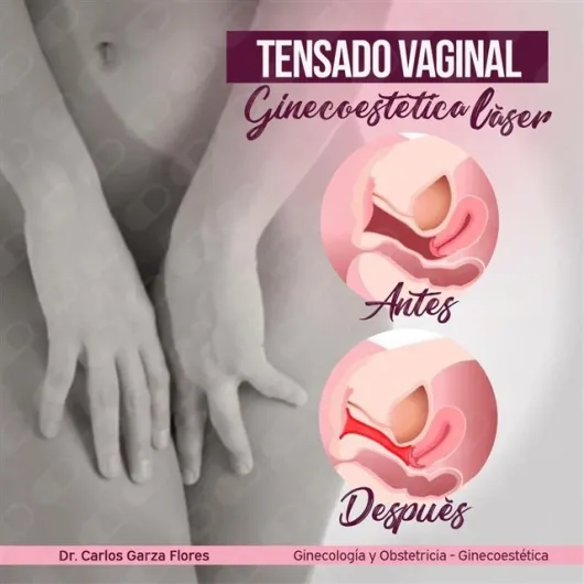 Foto 4 de Dr. Carlos Andrés Garza Flores, por Dr. Carlos Andrés Garza Flores, Ginecólogo