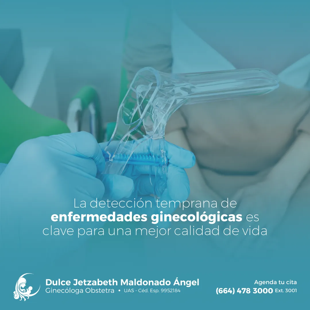 Foto 4 de Dra. Dulce Jetzabeth Maldonado Angel, por Ginecóloga en Tijuana - Dra. Dulce Jetzabeth Maldonado Angel
