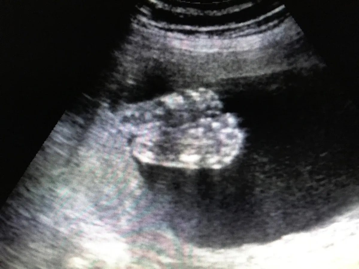 Foto 2 de y Pediatria, por Consultorio Medico Ginecologia y Pediatria