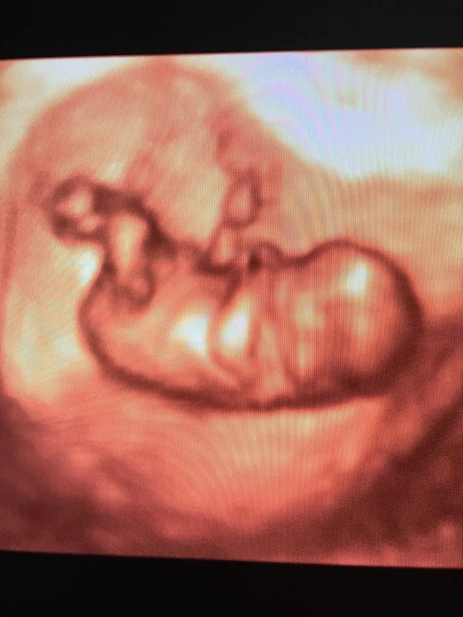 Foto 4 de y Pediatria, por Consultorio Medico Ginecologia y Pediatria