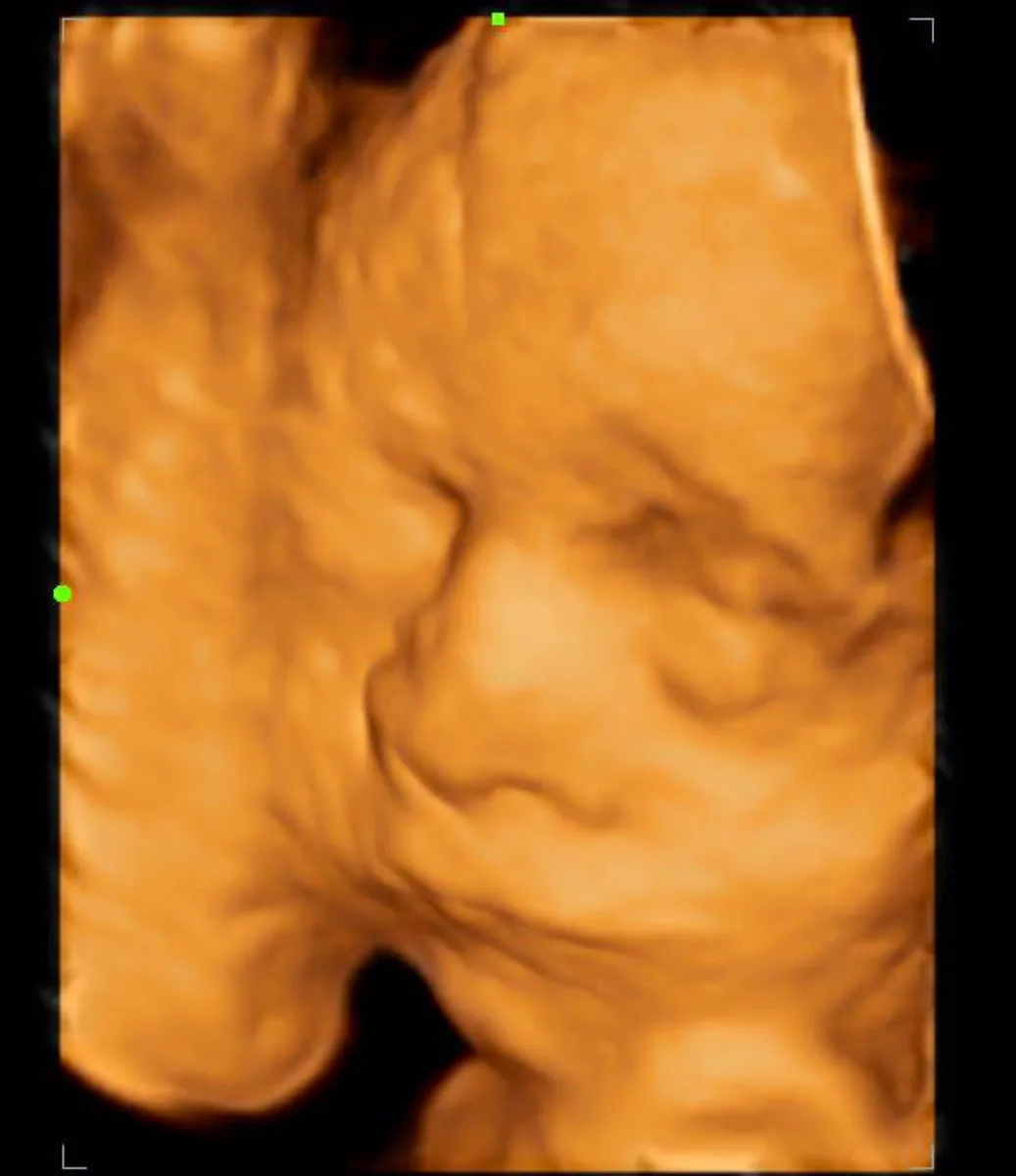 Foto 4 de Dra. Stefany Gómez, por Dra. Stefany Gómez | Ginecóloga y obstetra