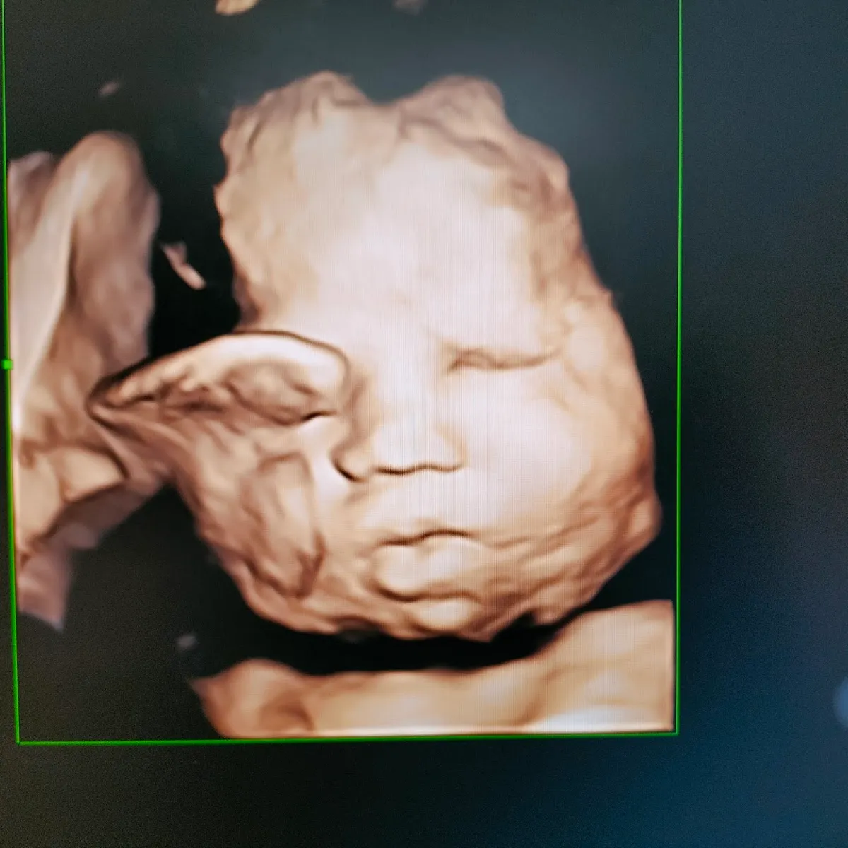 Foto 1 de / Urologia ginecologica, por Luz Gaspar