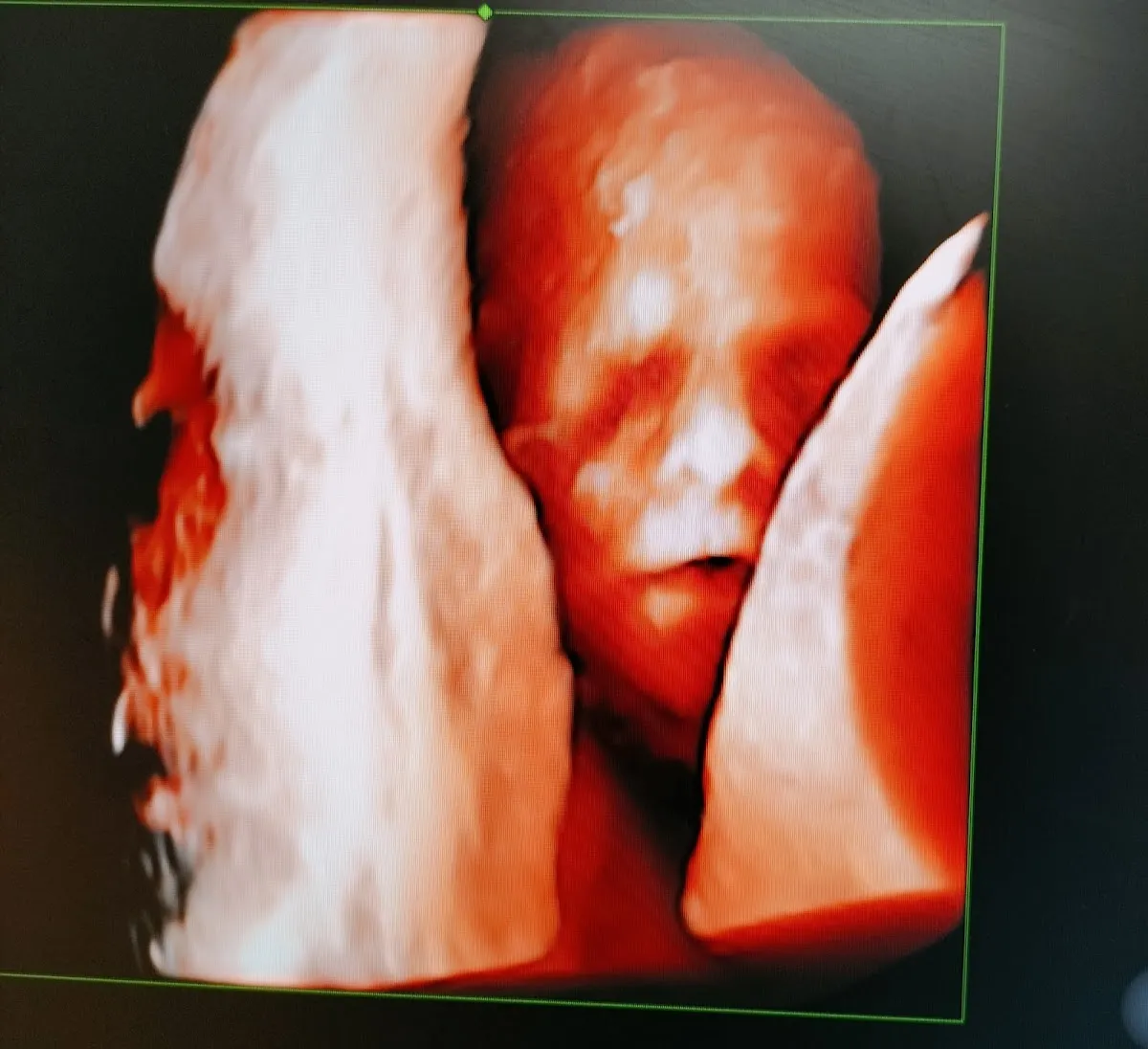 Foto 2 de / Urologia ginecologica, por Luz Gaspar