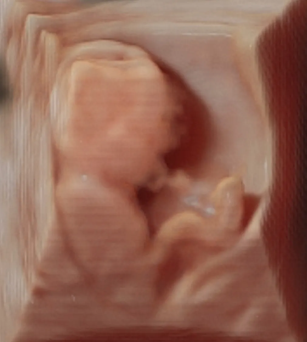 Foto 4 de Dra. Abril Mujica, por Dra. Abril Mujica - Ginecología, Obstetricia y Colposcopia