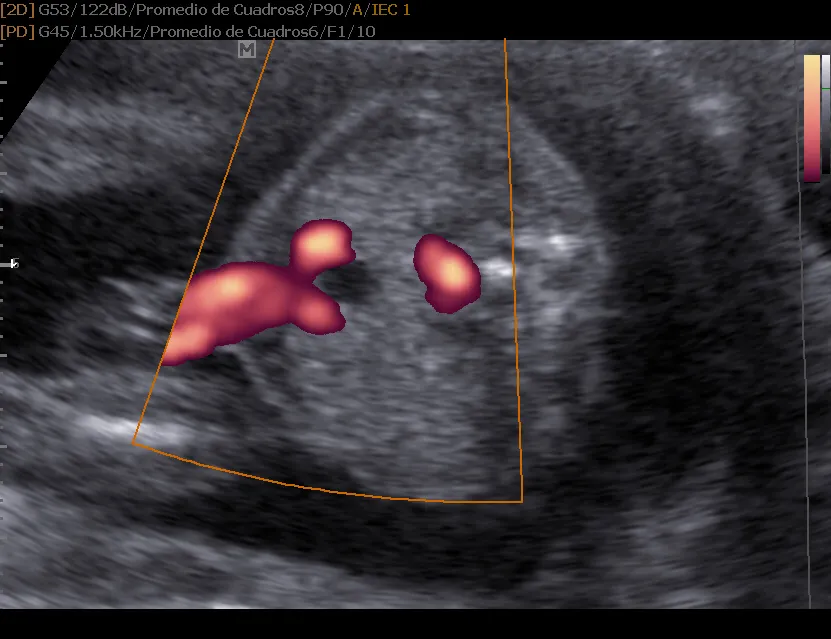 Foto 2 de Servicios Ginecologicos y Obstetricos Especializados, por SERVICIOS GINECOLOGICOS Y OBSTETRICOS ESPECIALIZADOS